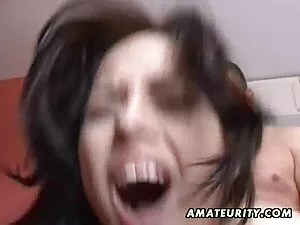 Skin - Nice branch A ...